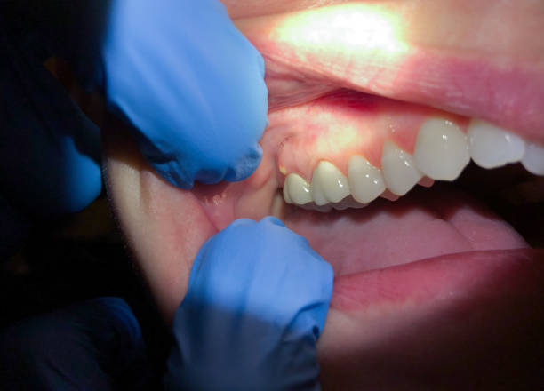 Best Emergency Treatment for Jaw Pain or Injury in Bronson, MI